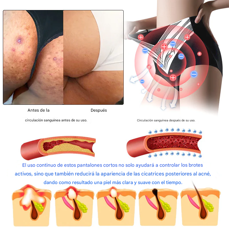 Pantalones cortos moldeadores de turmalina y fibra de titanio avanzados