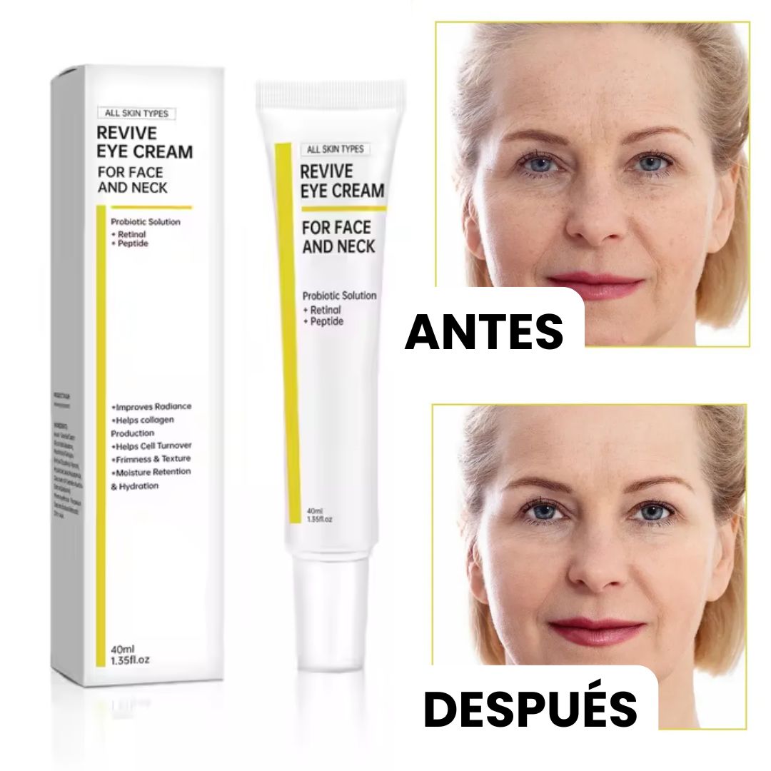 Crema Nida®: Despídete de esas ojeras que te envejecen en tan solo dias