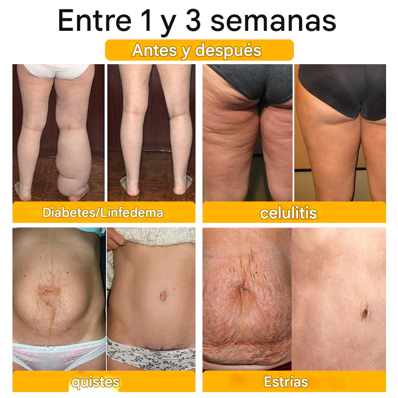 Pantalones cortos moldeadores de turmalina y fibra de titanio avanzados