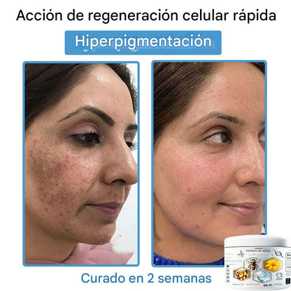 Crema Solución Natural de Abeja para la Piel