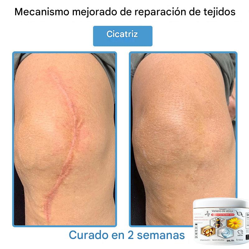 Crema Solución Natural de Abeja para la Piel