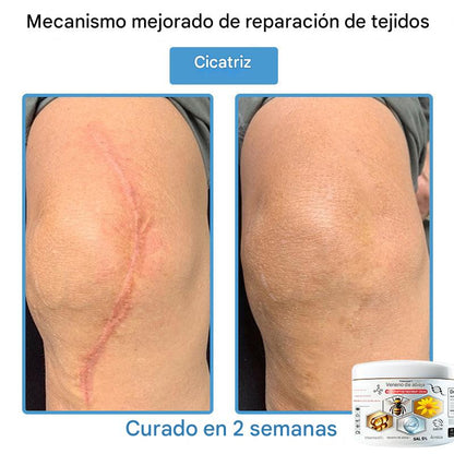 Crema Solución Natural de Abeja para la Piel
