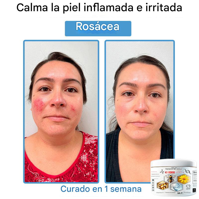 Crema Solución Natural de Abeja para la Piel