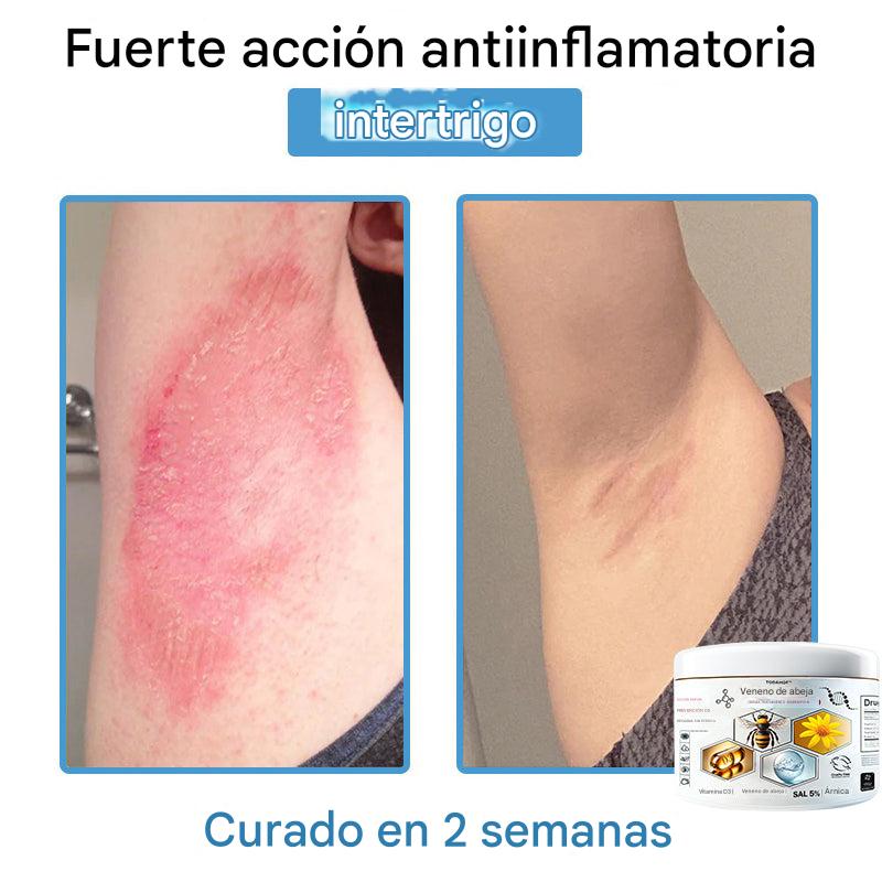 Crema Solución Natural de Abeja para la Piel