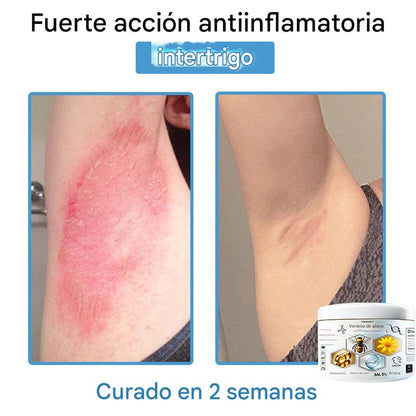 Crema Solución Natural de Abeja para la Piel