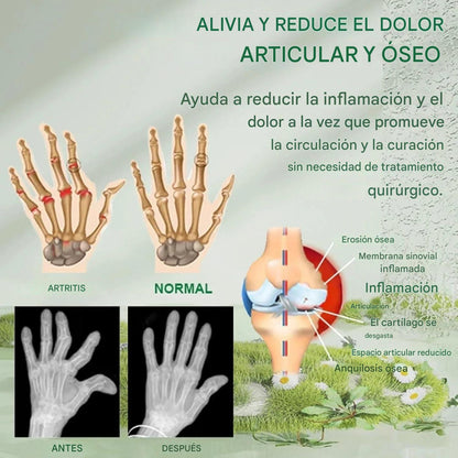Crema veneno de abeja para el dolor articular - Compra y llévate la segunda gratis🔥