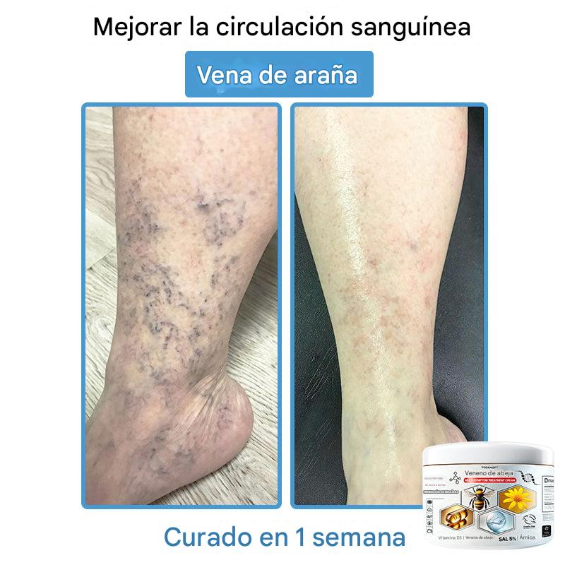 Crema Solución Natural de Abeja para la Piel
