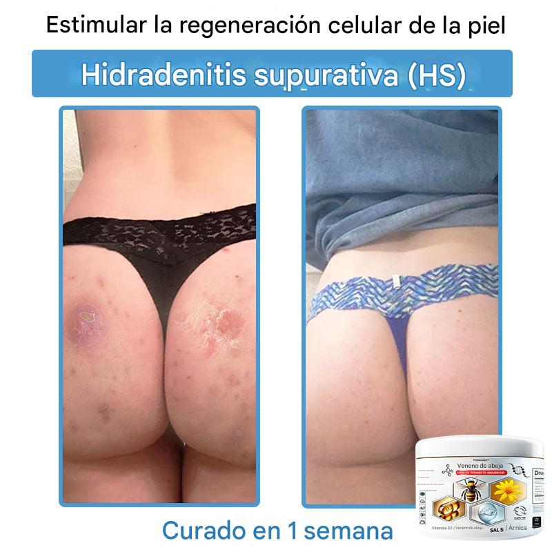 Crema Solución Natural de Abeja para la Piel