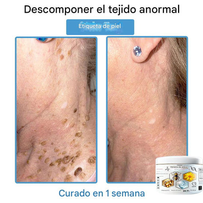 Crema Solución Natural de Abeja para la Piel
