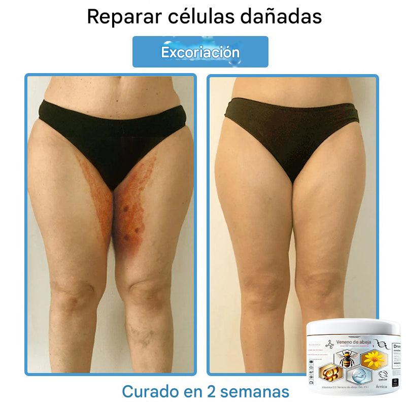 Crema Solución Natural de Abeja para la Piel