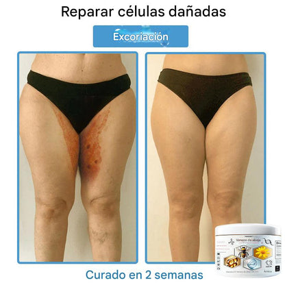 Crema Solución Natural de Abeja para la Piel