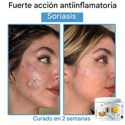 Crema Solución Natural de Abeja para la Piel