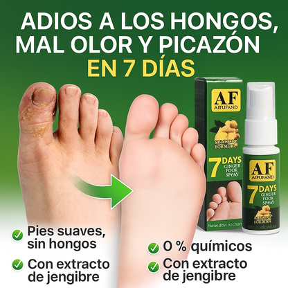🌿 GingerFeet™ | Elimina los hongos de los pies y la picazón de tus pies en solo 7 DÍAS