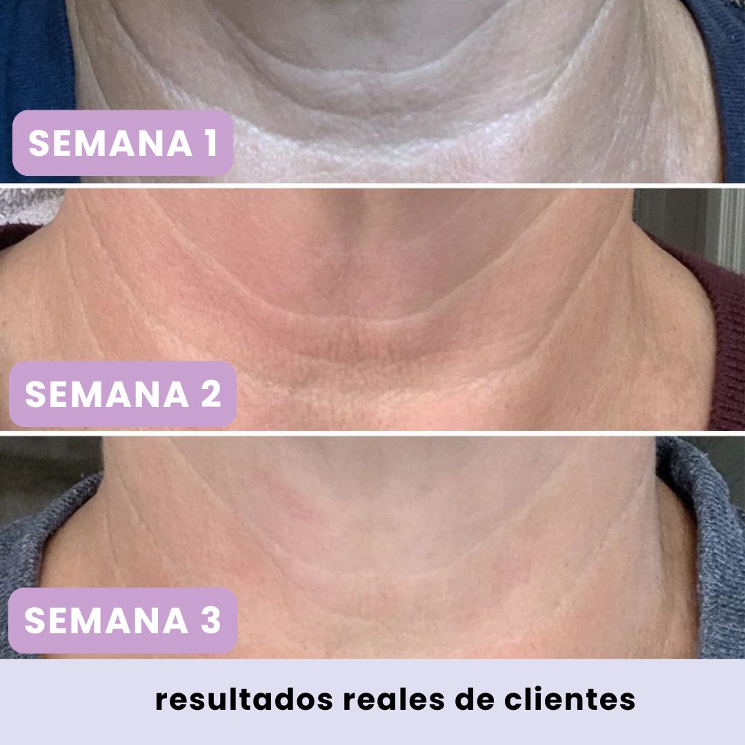 CREMA LUMÉRA™ Reafirma, Alisa y Rejuvenece tu cuello en 28 dias