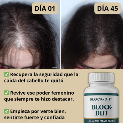 Block-DHT®: Cabello nuevo y autoestima renovada.