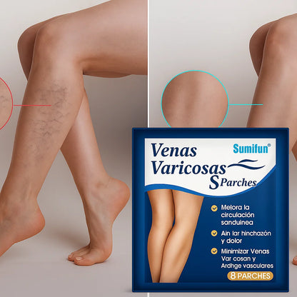 Varicose Veins Active™ – Piernas ligeras y activas todo el día.