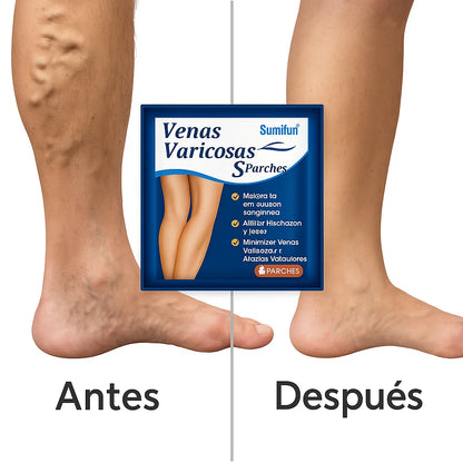 Varicose Veins Active™ – Piernas ligeras y activas todo el día.